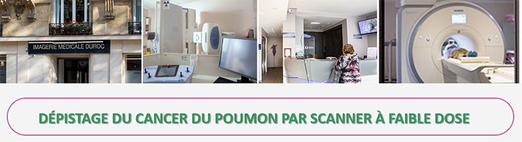 Dépistage du cancer du poumon par scanner à faible dose