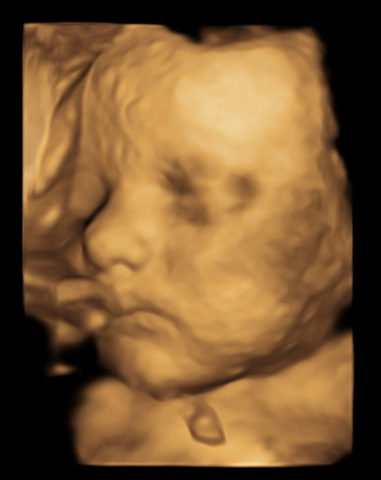 Echographie Obstetricale Imagerie Duroc Echographie Obstetricale Imagerie Duroc
