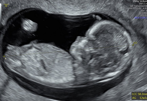 Echographie Obstetricale Imagerie Duroc Echographie Obstetricale Imagerie Duroc