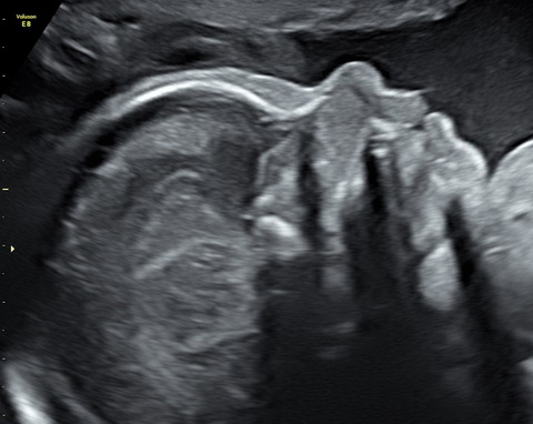 Echographie Obstetricale Imagerie Duroc