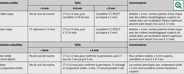 Tableau